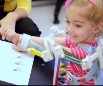 Un exosquelette imprimé en 3D pour une petite fille de 2 ans