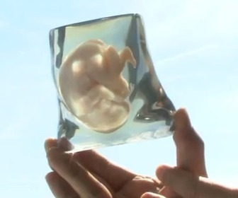 Une réplique 3D de son fœtus comme cadeau-souvenir